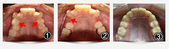 ortodoncia casos